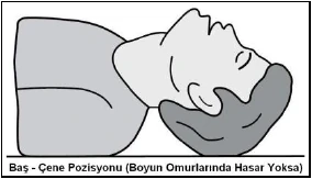 Solunum ve solunum yolu sorunları - açıklayıcı şekil 1