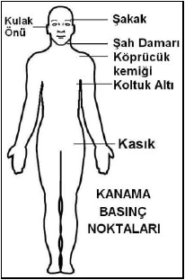 Kanamaların durdurulması ve şok - açıklayıcı şekil 1