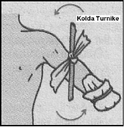 Kanamaların durdurulması ve şok - açıklayıcı şekil 2