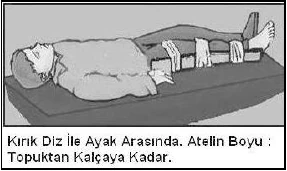Kırıklar, çıkıklar ve burkulmalar - açıklayıcı şekil 1